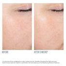 AlphaRet Exfoliating Peel Pads