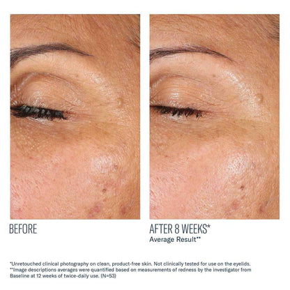 EyeMax AlphaRet Overnight Cream